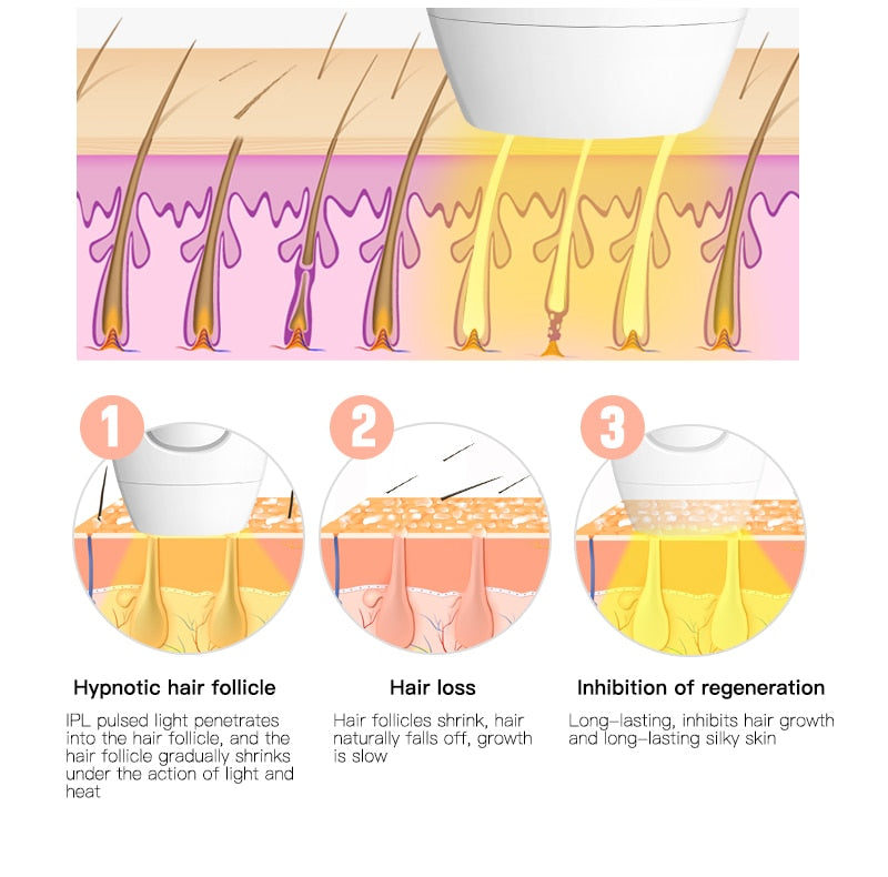 Electric Laser Hair Removal