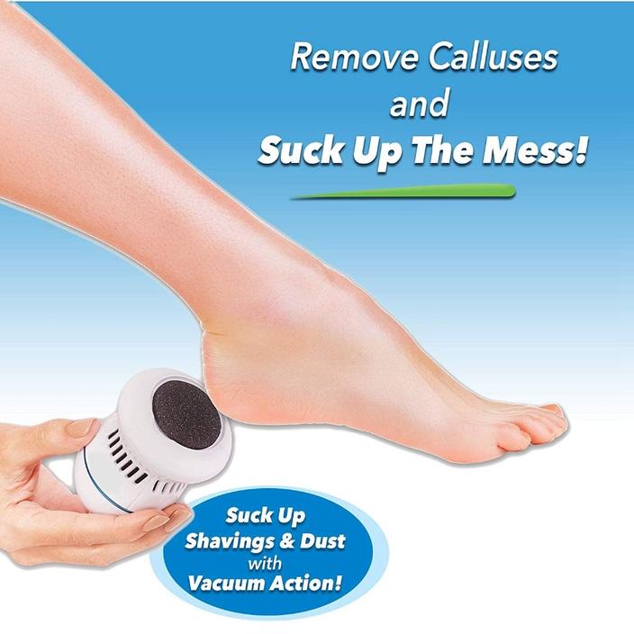 Electric Callus Remover with Built-In Vacuum